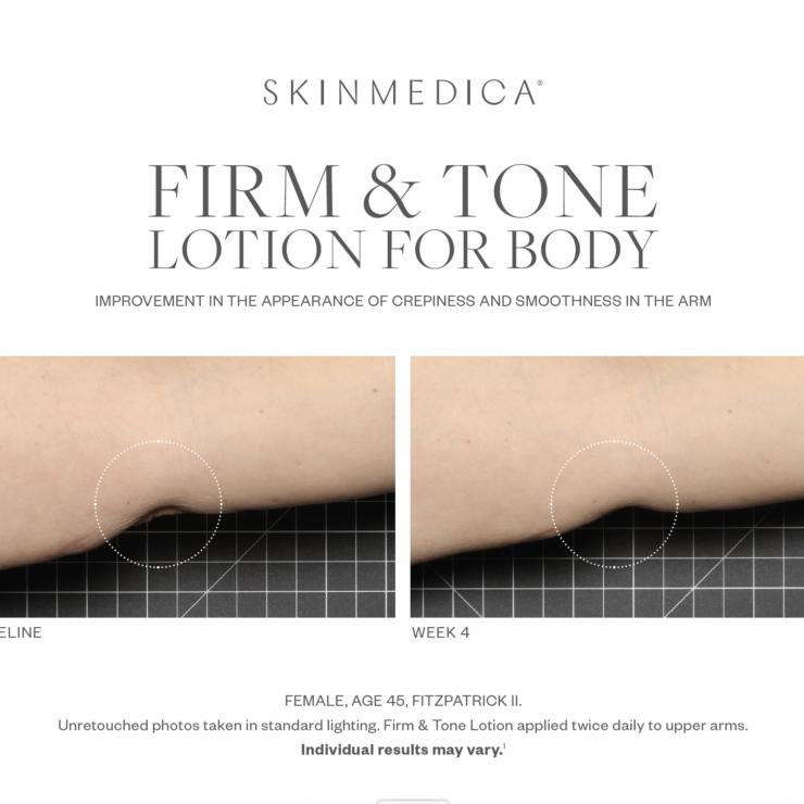 Screenshot 2025 03 07 At 11 54 24 Am Png 370x370@2x - Med Spa Scottsdale