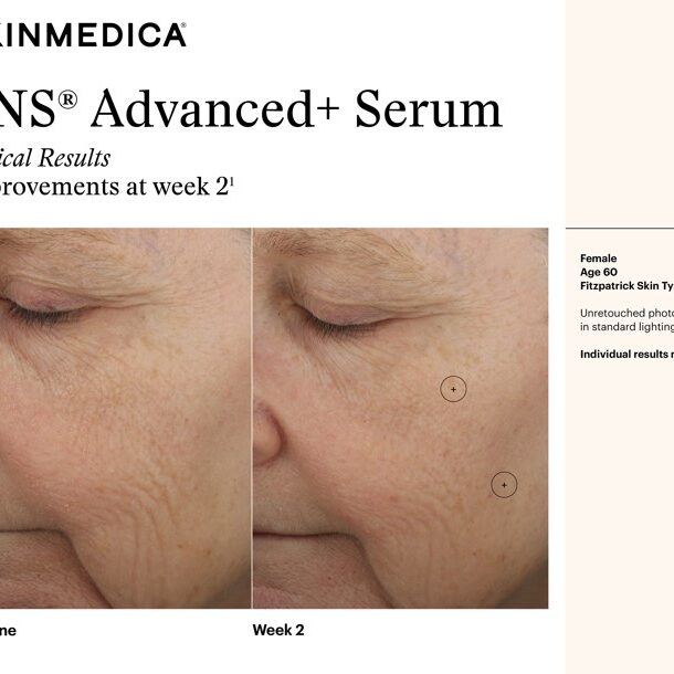 Tns Bas Jpg 370x370@2x - Med Spa Scottsdale