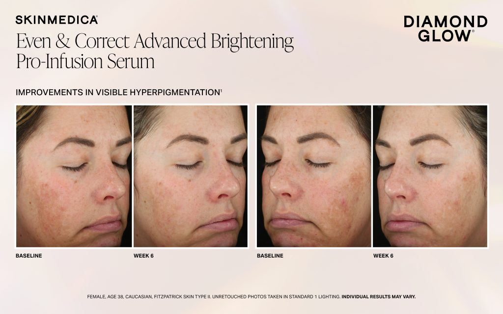 Dg Ec Pro Infusion Serum Week 6 Fitzii Scaled - Med Spa Scottsdale