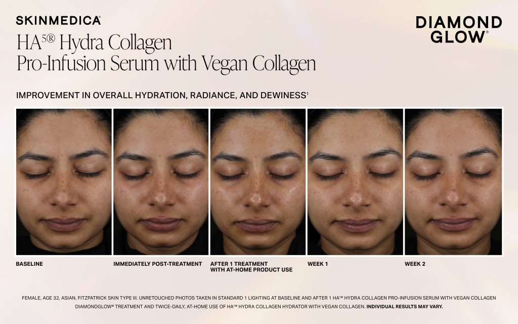 Dg Ha5 Hc Pro Infusion Serum Immediate Week 1 Week 2 Fitziii Scaled - Med Spa Scottsdale