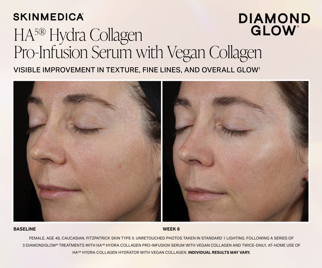 Dg Ha5 Hc Pro Infusion Serum Week 6 Fitzii Scaled - Med Spa Scottsdale