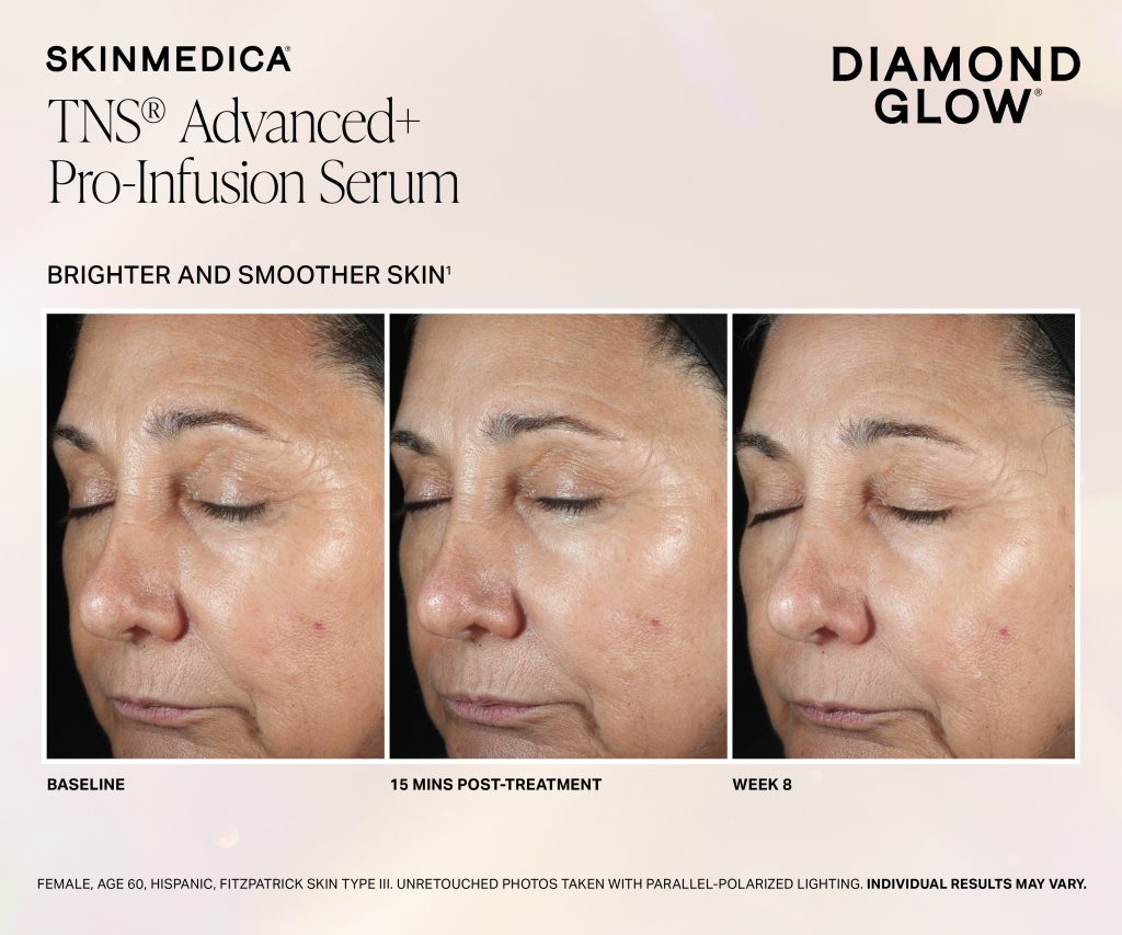 Dg Tns Pro Infusion Serum 15min Week 8 Ftitziii Scaled - Med Spa Scottsdale