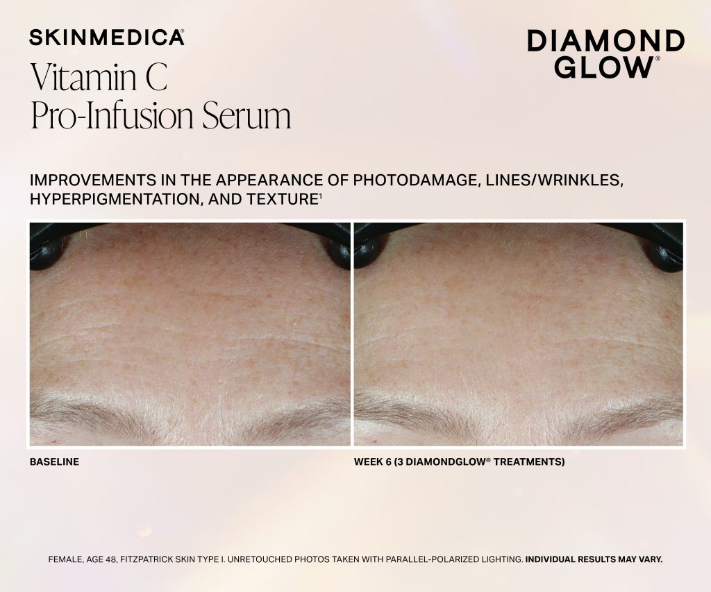 Dg Vitamin C Pro Infusion Serum Week 6 Fitzi Scaled - Med Spa Scottsdale
