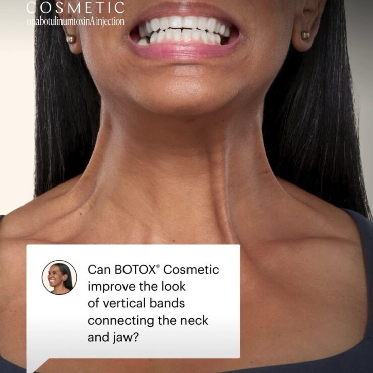Botox Cosmetic Turn Table Ba Social Post Devonna Jpg 370x370@2x - Med Spa Scottsdale